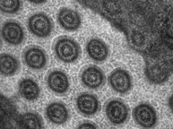 Electron Microscopy image of C.Elegans male