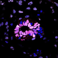 Light microscopy image of spinal cord tissue labeled with a nuclear stain, a proliferation marker, and a neural marker. The nuclear stain identifies the location and density of cell nuclei, the proliferation marker highlights actively dividing cells, and the neural marker labels neurons specifically. The combined fluorescent signals reveal cellular organization, regions of neural identity, and areas of active cell growth, illustrating the complex structure and regenerative activity within the spinal cord