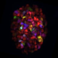 Light microscopy image of zebrafish pancreatic beta-cells labeled with multiple fluorescent colors. The different colors highlight individual beta-cells or groups of cells, illustrating their distribution and development. The image shows the variety and growth patterns of insulin-producing cells in the zebrafish pancreas