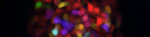 Light microscopy image of zebrafish pancreatic beta-cells labeled with multiple fluorescent colors. The different colors highlight individual beta-cells or groups of cells, illustrating their distribution and development. The image shows the variety and growth patterns of insulin-producing cells in the zebrafish pancreas