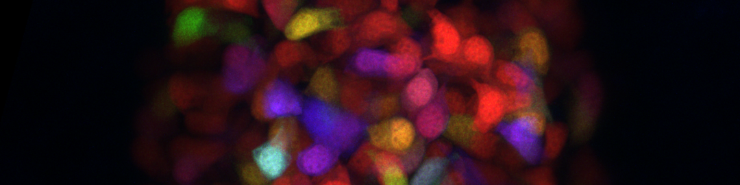 Light microscopy image of zebrafish pancreatic beta-cells labeled with multiple fluorescent colors. The different colors highlight individual beta-cells or groups of cells, illustrating their distribution and development. The image shows the variety and growth patterns of insulin-producing cells in the zebrafish pancreas