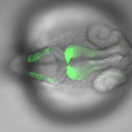 Transmitted Light and Fluorescence Microscopy image of the fluorescently labeled zebrafish embryo brain