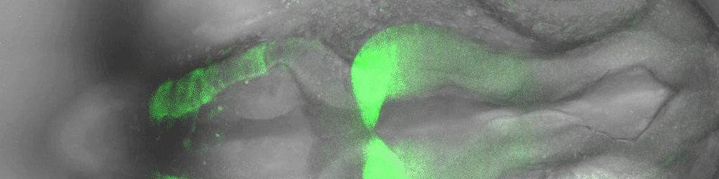 Transmitted Light and Fluorescence Microscopy image of the fluorescently labeled zebrafish embryo brain
